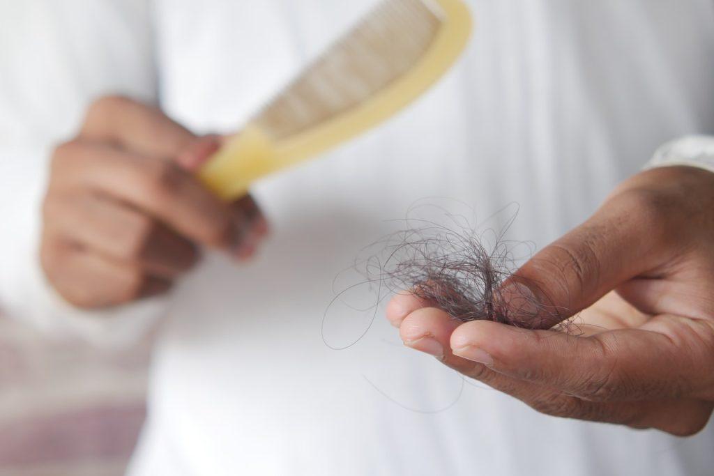 The Alopecia Connection Between Testosterone and Hair Loss, a hand holding hair that fell from a brush